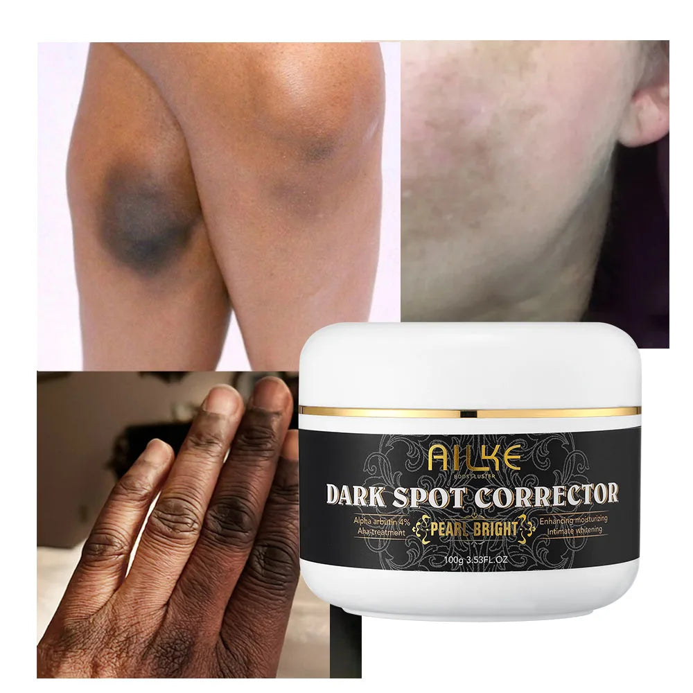 AILKE Organic Dark Spot Corrector/Knuckle Whitening Cream/Sun Spots/Age Spot Remover